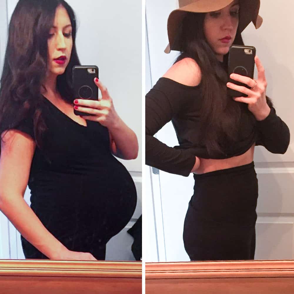 Read more about the article Belly Bandit Before and After